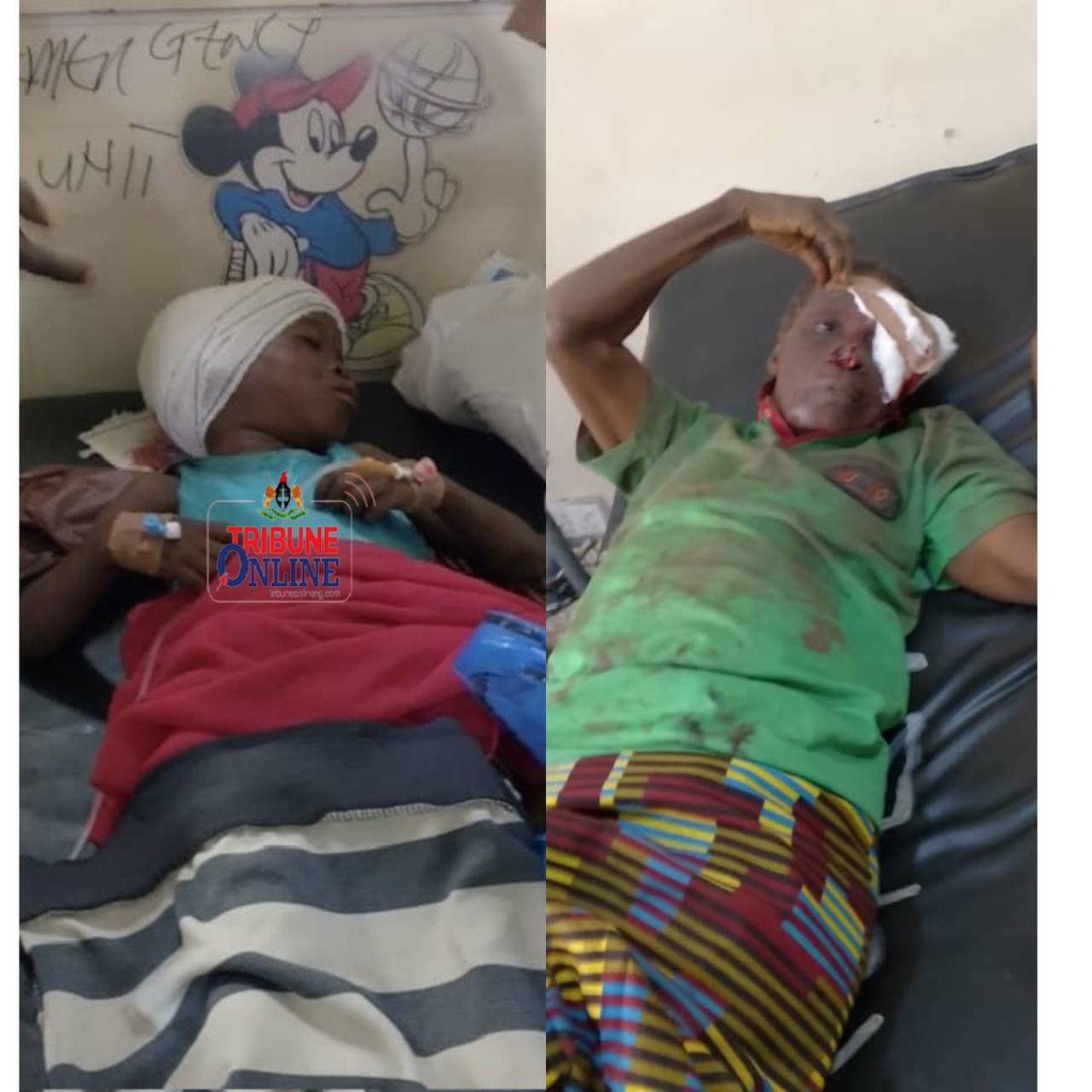 Dog eats flesh off girl’s head, attacks owner trying to protect victim in Oyo 1 IMG 20240710 112853 814