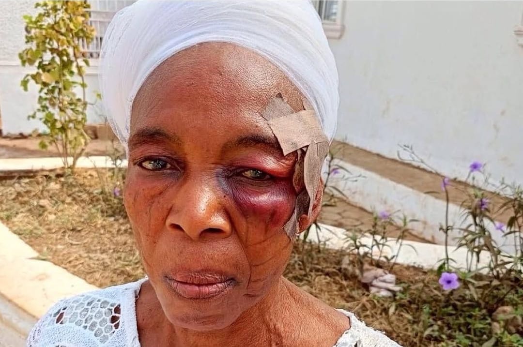 Six injured as Isese worshippers come under attack in Osun State. 1 1737818084953