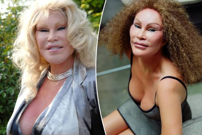 Jocelyn Wildenstein, ‘Catwoman’ socialite known for her extreme cosmetic surgery, dies 1 images 18 2